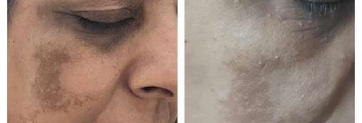 Acupuncturist Dr Dikssha and Dr Ranjana