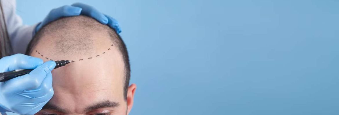 Ayushman Hair Transplant Centre