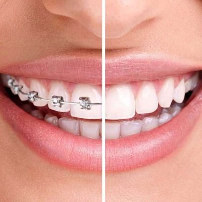 Cusp Dental & Maxillofacial Centre