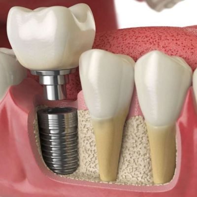Cusp Dental & Maxillofacial Centre