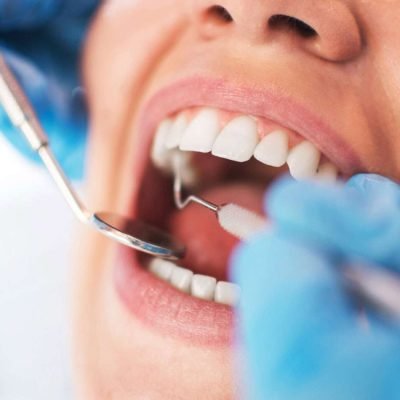 Cusp Dental & Maxillofacial Centre