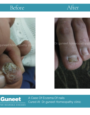 Dr Guneet clinic for incurable diseases