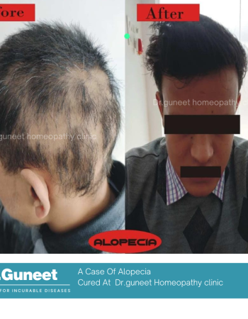 Dr Guneet clinic for incurable diseases