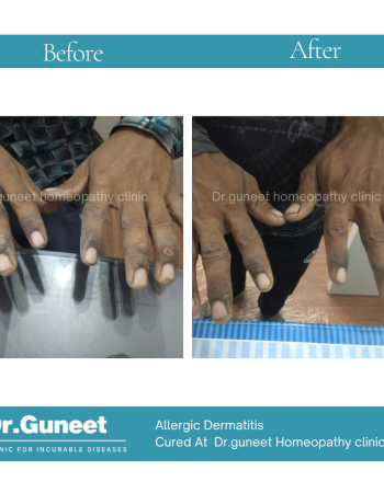 Dr Guneet clinic for incurable diseases