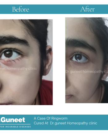 Dr Guneet clinic for incurable diseases