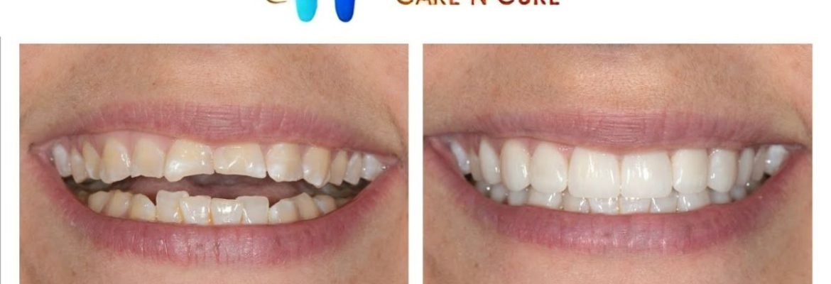 Dental Care N Cure Clinic